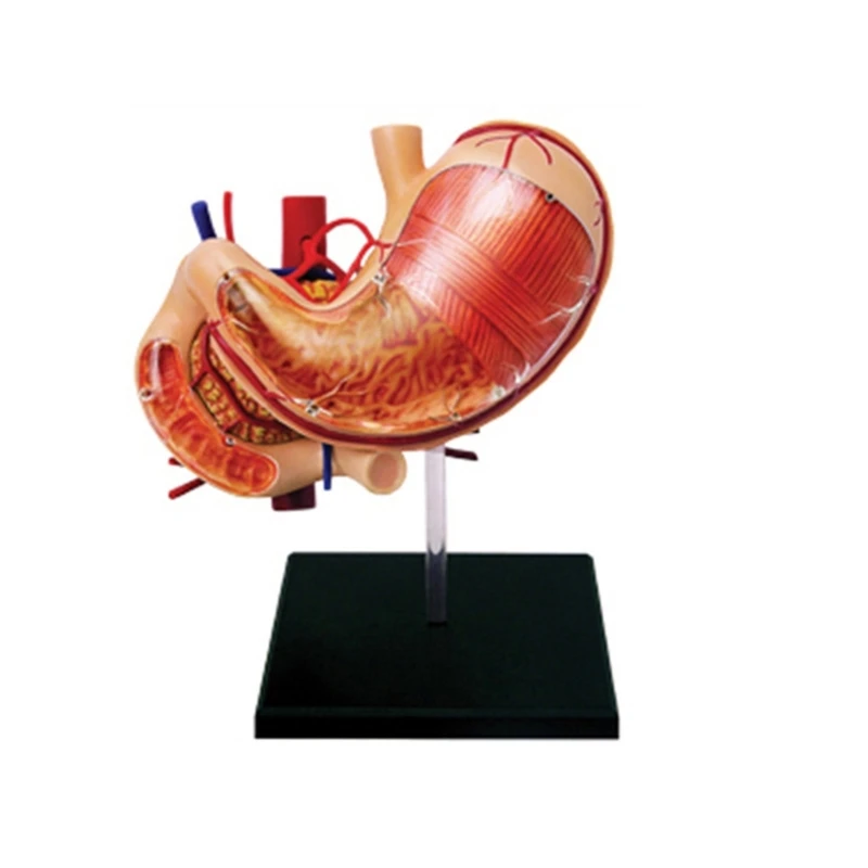 Медицинская модель человеческого желудка и поджелудочной железы Инструмент для обучения анатомии патологии желудка